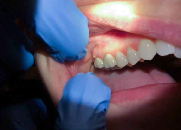 Best Pediatric Emergency Dentist in Tomahawk, WI